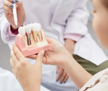 dentalimplants