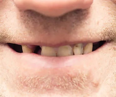 Oral-Health