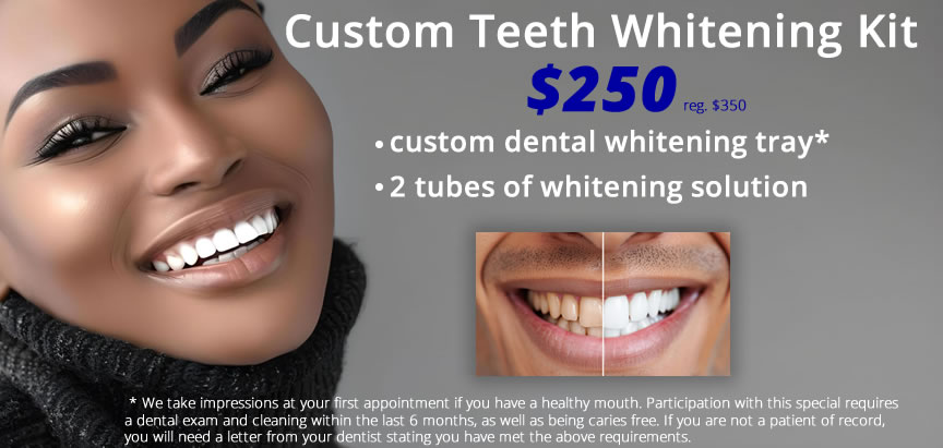 special offer teeth whitening